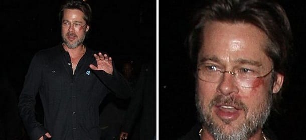 Brad Pitt e quei lividi sulla faccia: cos'è successo?