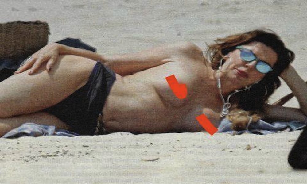 Con l'arrivo dell'estate si moltiplicano i topless [FOTO]