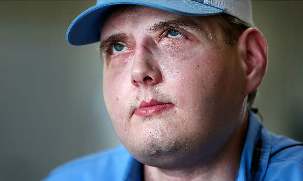 Spende un milione di dollari per un intervento al viso. Ciò che accade è emozionante... [VIDEO]