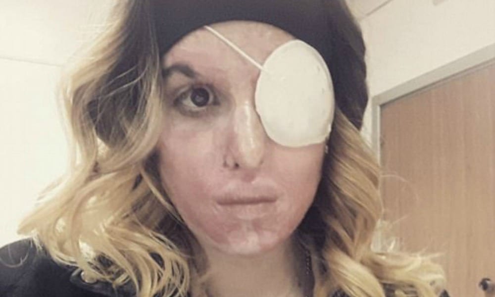 Gessica Notaro rivede il suo aggressore: "Come non dormo io la notte, non deve dormire lui" [VIDEO]