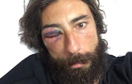 Vittorio Brumotti: nuova aggressione per l'inviato di Striscia