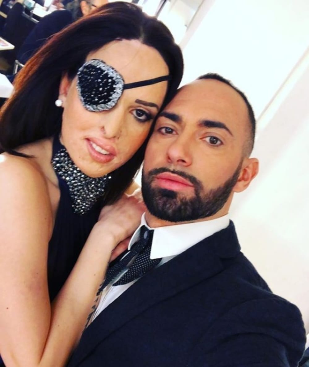 Ballando con le Stelle, Gessica Notaro pronta a tutto: la neve di Roma non la scalfisce [VIDEO]