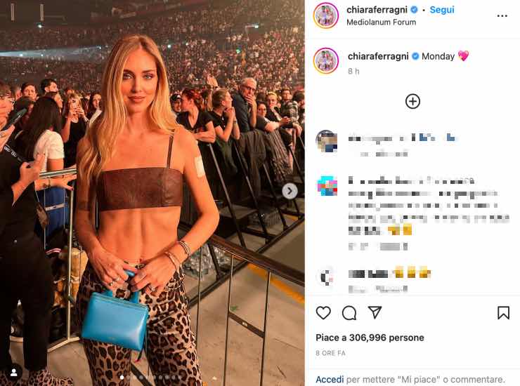 Chiara Ferragni Instagram cerotto