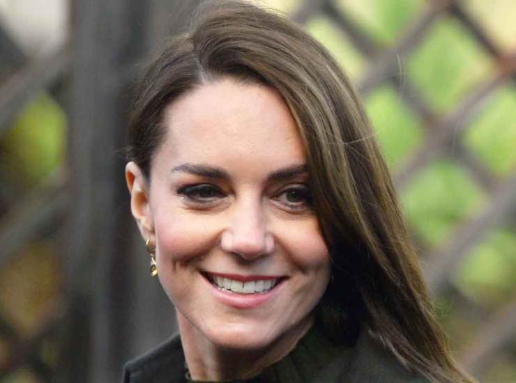 Kate Middleton botox naturale