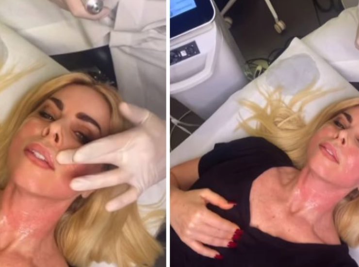 Loredana Lecciso trattamento